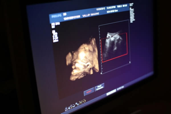 Ultrazvučni pregledi